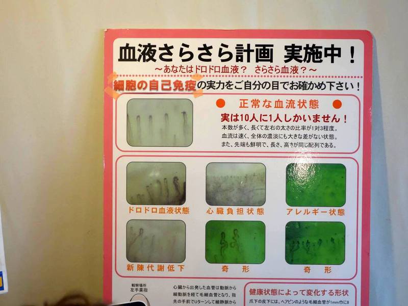 左手の指先の血流を検査で、水分摂取不足、浅い呼吸を改善することに努めます 左手の指先の血流を検査で、水分摂取不足、浅い呼吸を改善することに努めます