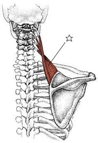 左右の肩の位置と痛み