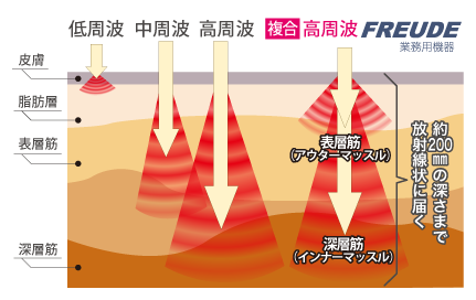 なぜ、今 EMS なのか なぜ、今 EMS なのか