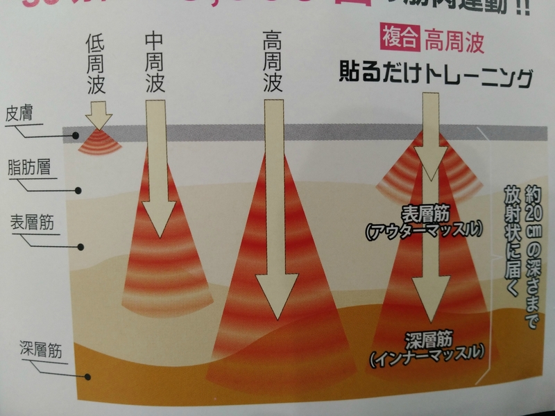 みなとまち接骨院で貼るだけインナートレーニングを みなとまち接骨院で貼るだけインナートレーニングを