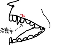 うんざり敗者（歯医者）２