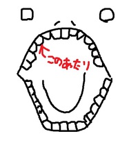 うんざり敗者（歯医者）