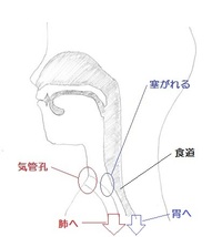 「喉頭がん手術後の首・肩の痛み」症例紹介です