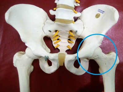 「股関節の痛み」症例紹介です