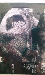 子宮についてつぶやいてみた。