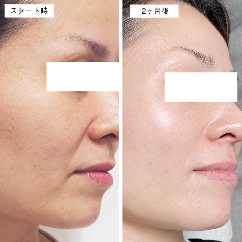 超美品 モリーズ 肌ファス 美白 - htii.edu.kz