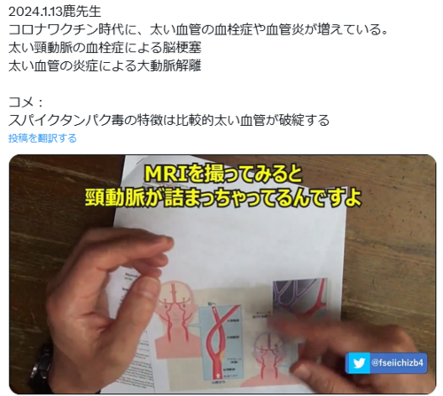 ★意識喪失事故の検証って？
