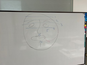 浜松勉強会/顔面麻痺。
