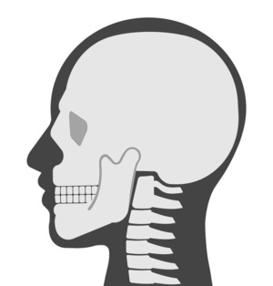 顎関節症と骨盤（腸骨）